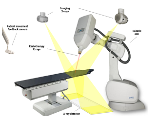CyberKnife sisteminin bileşenlerini gösteren kaynak görsel